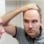 Hair Loss on Keto diet